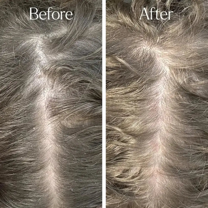 Only Curls Detox Clarifying Shampoo